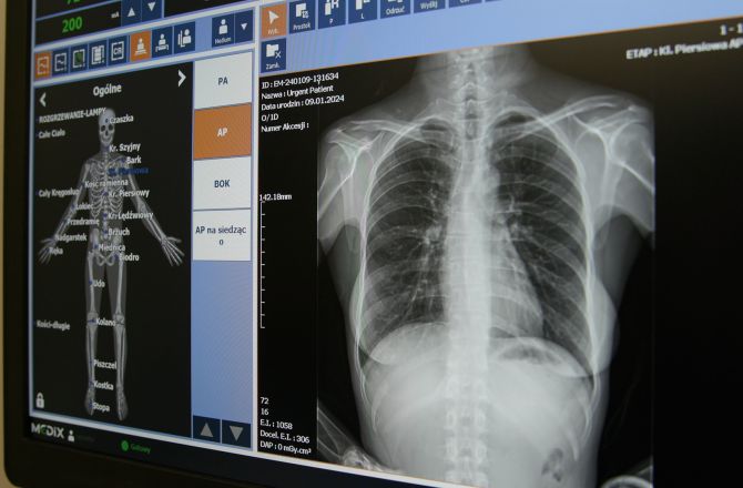 Otwarcie nowej pracowni radiologii Kolegium Nauk Medycznych Uniwersytetu Rzeszowskiego